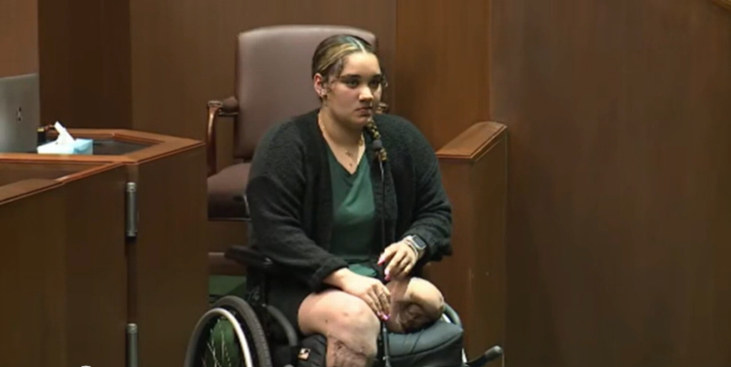 Teen volleyball player lost legs in Missouri crash. Driver found guilty, officials say - Yahoo! Voices